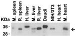 MyD88 Antibody in Western Blot (WB)