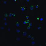 MyD88 Antibody in Immunocytochemistry (ICC/IF)