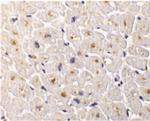 DcR3 Antibody in Immunohistochemistry (IHC)