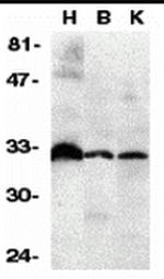 DcR3 Antibody in Western Blot (WB)