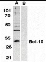 Bcl-10 Antibody in Western Blot (WB)