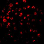 IRAK2 Antibody in Immunocytochemistry (ICC/IF)