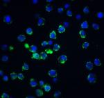 Acinus Antibody in Immunocytochemistry (ICC/IF)