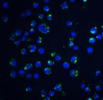 Acinus Antibody in Immunocytochemistry (ICC/IF)