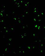 Acinus Antibody in Immunocytochemistry (ICC/IF)