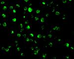 AIF Antibody in Immunocytochemistry (ICC/IF)