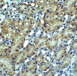 RIP3 Antibody in Immunohistochemistry (Paraffin) (IHC (P))