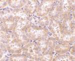 RIP3 Antibody in Immunohistochemistry (Paraffin) (IHC (P))