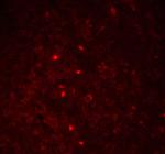 PYCARD Antibody in Immunohistochemistry (Paraffin) (IHC (P))