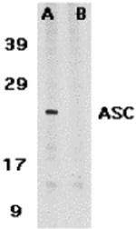 PYCARD Antibody in Western Blot (WB)