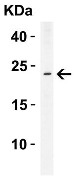 PYCARD Antibody in Western Blot (WB)