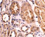 BNIP3L Antibody in Immunohistochemistry (IHC)