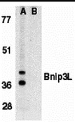 BNIP3L Antibody in Western Blot (WB)