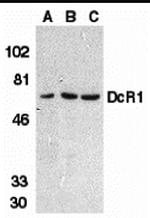 CD263 (TRAIL-R3) Antibody in Western Blot (WB)
