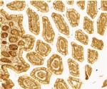 DC-SIGN Antibody in Immunohistochemistry (IHC)