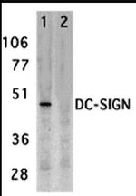 DC-SIGN Antibody in Western Blot (WB)
