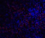 IRAK-M Antibody in Immunocytochemistry (ICC/IF)