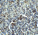 IRAK-M Antibody in Immunohistochemistry (IHC)