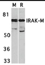 IRAK-M Antibody in Western Blot (WB)