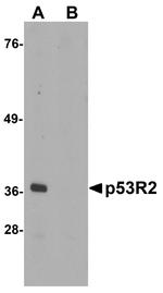 p53R2 Antibody in Western Blot (WB)