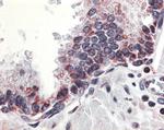 APRIL Antibody in Immunohistochemistry (IHC)