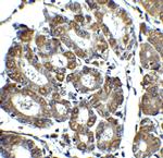 NOXA Antibody in Immunohistochemistry (IHC)