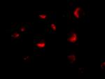 MTA2 Antibody in Immunocytochemistry (ICC/IF)