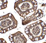 MTA2 Antibody in Immunohistochemistry (IHC)