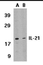 IL-21 Antibody in Western Blot (WB)