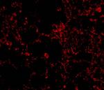 IL21R Antibody in Immunocytochemistry (ICC/IF)