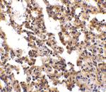 IL21R Antibody in Immunohistochemistry (IHC)