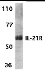 IL21R Antibody in Western Blot (WB)