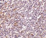 TCCR Antibody in Immunohistochemistry (IHC)