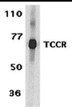 TCCR Antibody in Western Blot (WB)