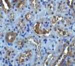 IL-22 Receptor alpha Antibody in Immunohistochemistry (IHC)