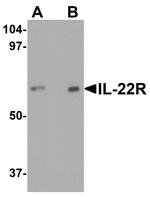 IL-22 Receptor alpha Antibody in Western Blot (WB)