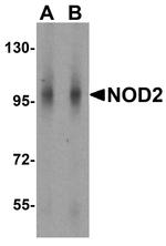 NOD2 Antibody in Western Blot (WB)