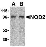 NOD2 Antibody in Western Blot (WB)