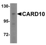 CARD10 Antibody in Western Blot (WB)