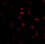 AATF Antibody in Immunocytochemistry (ICC/IF)