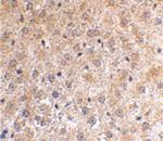 p53DINP1 Antibody in Immunohistochemistry (IHC)