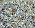 CD268 (BAFF Receptor) Antibody in Immunohistochemistry (IHC)