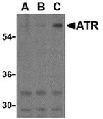 TEM8 Antibody in Western Blot (WB)