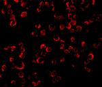 TRAF6 Antibody in Immunocytochemistry (ICC/IF)