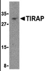 TIRAP Antibody in Western Blot (WB)