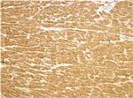 TIRAP Antibody in Immunohistochemistry (IHC)