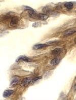 TRIF Antibody in Immunohistochemistry (IHC)