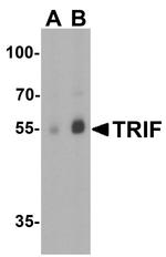 TRIF Antibody in Western Blot (WB)