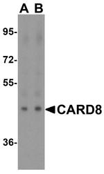 CARD8 Antibody in Western Blot (WB)