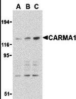 CARD11 Antibody in Western Blot (WB)